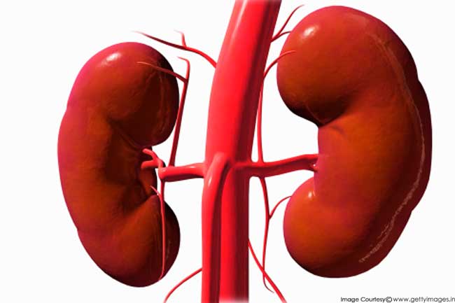 Polycystic Kidney Disease